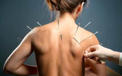 L’acupuncture comme traitement complémentaire du mal de dos